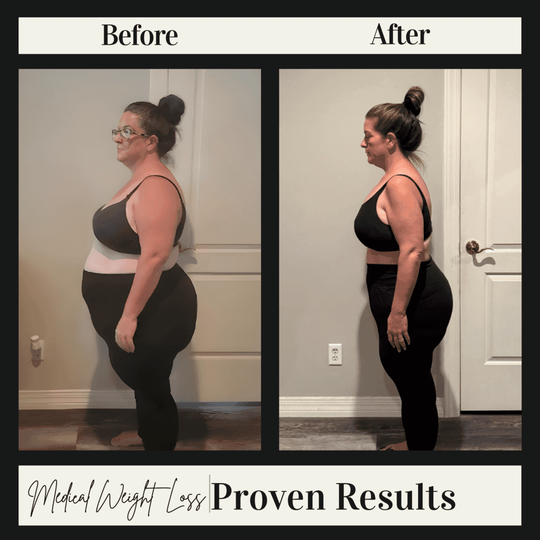 Why Non-Scale Victories Matter in Your Weight Loss Journey